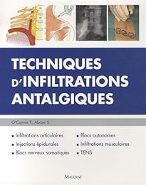 Techniques d'infiltrations antalgiques