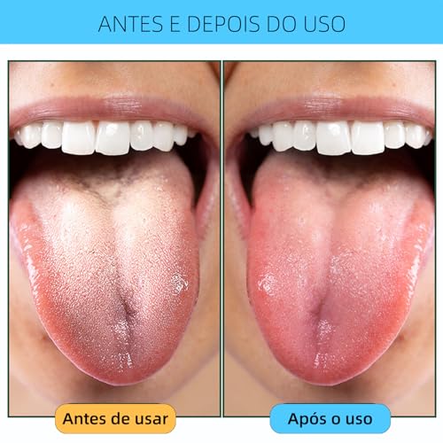 Raspador de Lingua, GODREAM Limpador de Lingua Inox com Estojo, Kit 5 Higiene Bucal, Limpeza Bucal Profunda, Elimina Mau Hálito, Remove Saburra, Lavável e Reutilizável, Essencial para Casa e Viagens