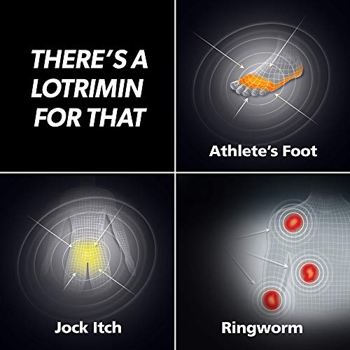5 Lotrimin+Antifungal+Prescription+Butenafine+Hydrochloride