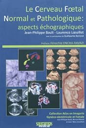 Le  cerveau foetal normal et pathologique