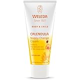 weleda baby eczema