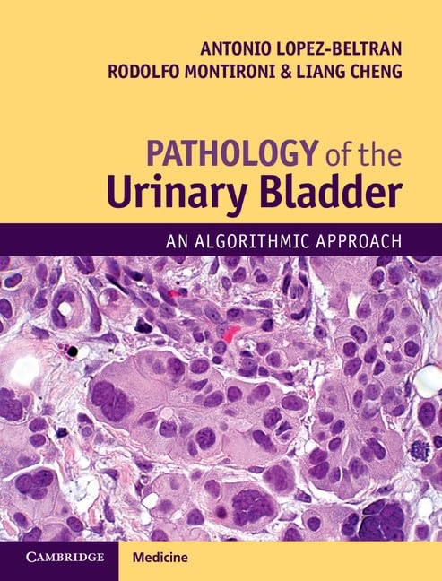 Pathology of the Urinary Bladder: An Algorithmic Approach