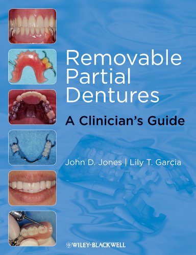 Removable Partial Dentures: A Clinician's Guide (Restorative Dentistry) - Thumbnail 3