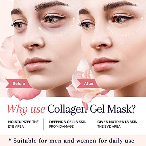 5 Under+Eye+Patches+Anti+Aging+Hyaluronic