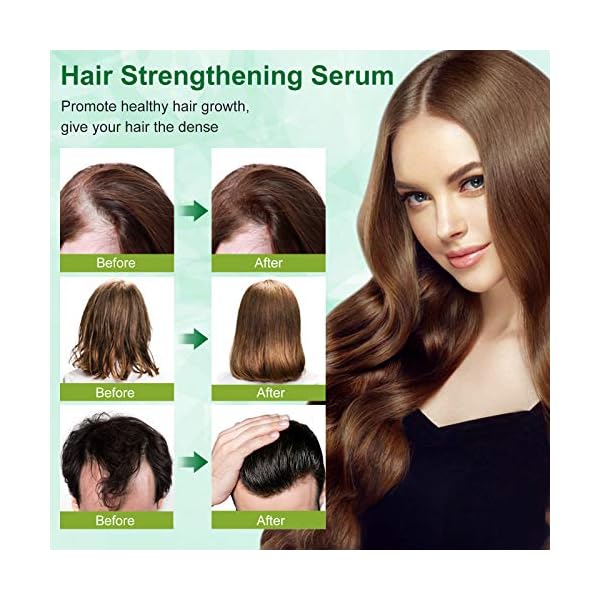 Hair-Growth-Serum-100ml-Hair-Growth-Treatment-Oil-Help-Hair-Follicle-Growth-Strengthen-Hair-Roots-Thickening-Regrowth-Hair-Loss-Treatment-for-Men-Women Hair Growth Serum, 100ml Hair Growth Treatment Oil, Help Hair Follicle Growth, Strengthen Hair Roots Thickening…