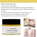 Scar Removal Cream,Scar Cream,Scar Treatment,Skin Repair Cream,Treatment for FaceBody Scar,Acne Spots,Stretch Mark Cream, Old and New Scars and Surgical Scars,For Men & Women 50ml