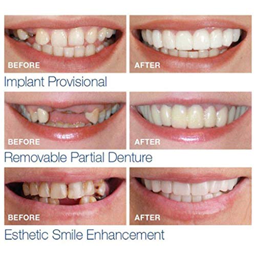 image for Fheaven (TM) Teeth Cosmetic Sticker - Temporary Smile Comfort Fit Cosm