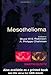 Mesothelioma