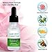 Aroamas, Dark Spot Corrector, Brightening Spotless Oil, lightens skin - For Face and Body - Even Skin tones - Anti-Aging - Jojoba Oil, Olive Oil, Rose Oil, Vitamin E