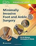 Minimally Invasive Foot & Ankle Surgery (Minimally Invasive Orthopaedic Surgery)