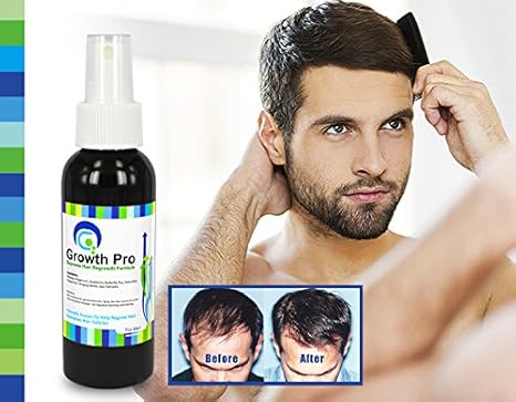 Serum gegen Haarausfall, mit Sägepalme und Ginseng, 8 leistungsstarke Kräuter, Formel für Haarausfall,Wachstum, DHT-Blocker, 