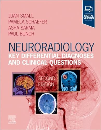 Imaging of Neurodegenerative Disorders: 9781604068542: Medicine