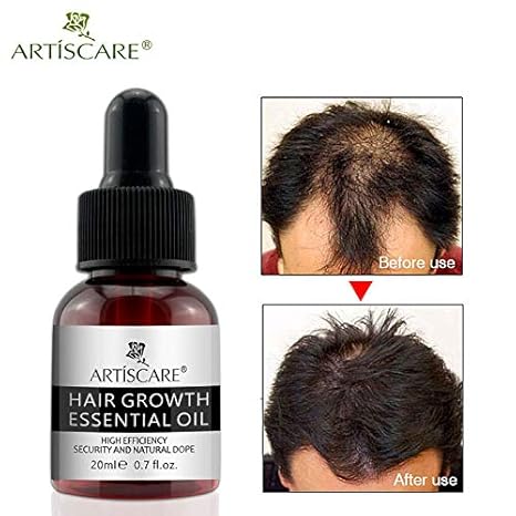 Shreeyas Artiscare Hair Growth Essential Oil Ginseng Anti Hair