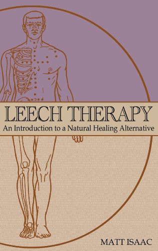 Leech Therapy: An Introduction to a Natural Healing Alternative
