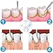 6 Pcs Dental Tools Kit, Dentist Picks Plaque Remover Scraper Set Best for Personal Use