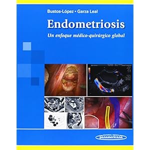 Endometriosis: Un enfoque medico-quirurgico global / A Comprehensive Medical and Surgical Approach