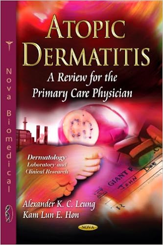 atopic dermatitis care