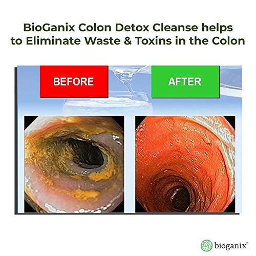 Bioganix Colon Detox and Weight Loss Supplement with Herbal Formula for Adults, 120 Capsules