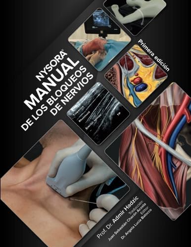 NYSORA Nerve Block Manual: First Edition (Regional Anesthesia