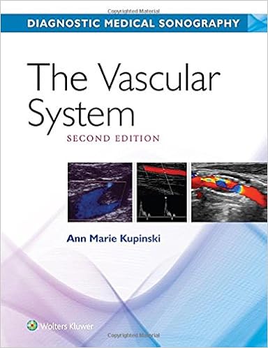 The Vascular System Diagnostic Medical Sonography Series Kuski Ann Marie 9781496380593 Books The Vascular System Diagnostic Medical Sonography Series Kuski Ann Marie 9781496380593 Books
