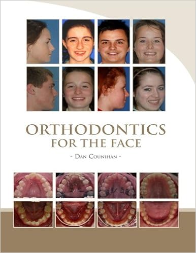 Orthodontics For The Face