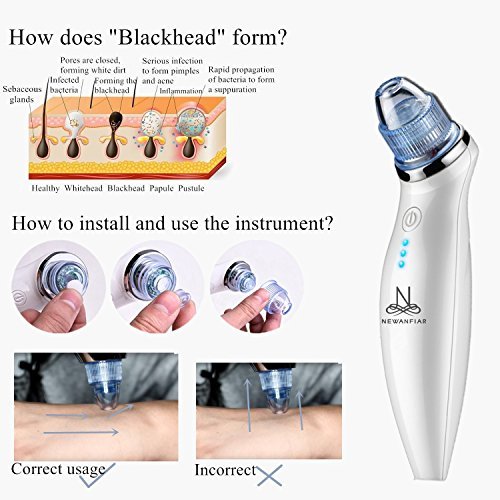 NEWANFIAR X6 Mitesser Entferner Mitesser Sauger Porenreiniger Sauger 5 Aufsätze USB-Aufladung Blu-ray-Design