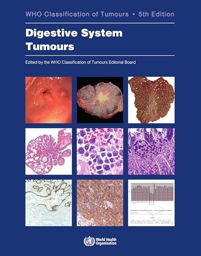Breast Tumours: WHO Classification of Tumours (Medicine