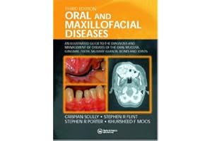Oral and Maxillofacial Diseases: An Illustrated Guide to Diagnosis and Management of Diseases of the Oral Mucosa, Gingivae, T