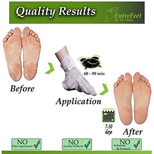Dr. Entre's Exfoliating Foot Peel Mask | 4 Coconut Pairs | Natural Exfoliant For Smooth Baby Soft Feet, Dry Dead Skin Treatment, Repair Rough Heels, Callus Remover Sock Booties - Thumbnail 3