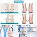 Medial & Lateral Heel Wedge Silicone Insoles, Supination & Pronation Corrective Heel Insoles, Gel Adhesive Shoe Inserts for Foot Alignment, Knock Knee Pain, Bow Legs, O/X Type Legthumb 1