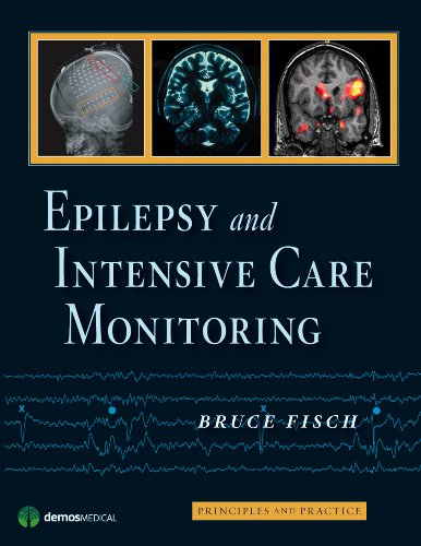 Epilepsy and Intensive Care Monitoring: Principles and Practice - //medicalbooks.filipinodoctors.org