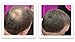 Hair Powder For Thinning Hair. Makes Thin Hair Look 10X Fuller, Covers Bald Spot Instantly. All-Natural Hair Building Fiber. Trial Size (10-Day Supply). Black