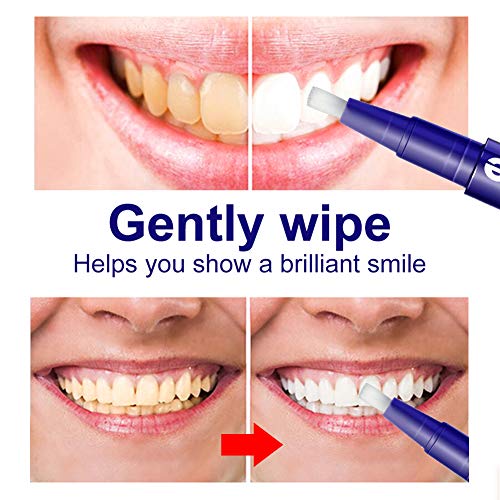 Teeth Whitening Pen (4 Pack), Effective Carbamide Peroxide Gel