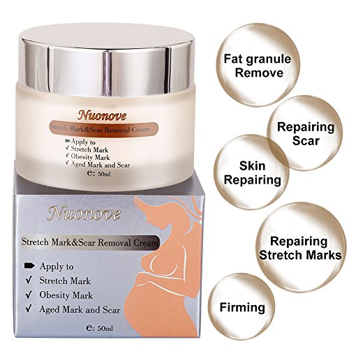 3 Lavender+Migraine+Headaches+Relief+Happy