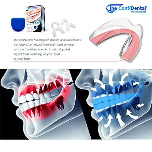 4 ConfiDental+Moldable+Clenching+Whitening+Including