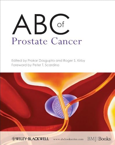Download ABC of Prostate Cancer PDF