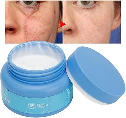 regeneration cream for acne scars