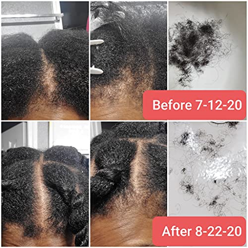 Silk Growth Oil with 6 Organic Essentials for Rapid Hair Growth, Shine, Strength, and Elasticity - Repairs, Balances pH, Prevents Breakage
