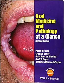 Oral Medicine and Pathology at a Glance (At a Glance (Dentistry)) Oral Medicine and Pathology at a Glance (At a Glance (Dentistry))