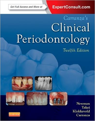 Periodontology for the Dental Hygienist  EBook Perry Periodontology for the Dental Hygienist