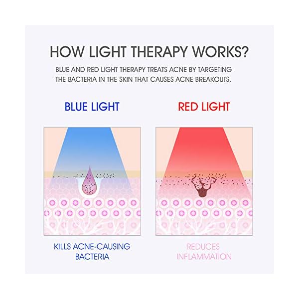 Hangsun Light Therapy Mask Acne Treatment Unlimited Sessions for Face Skin Care FT330-2 in 1 Works for 10 Mins Daily…