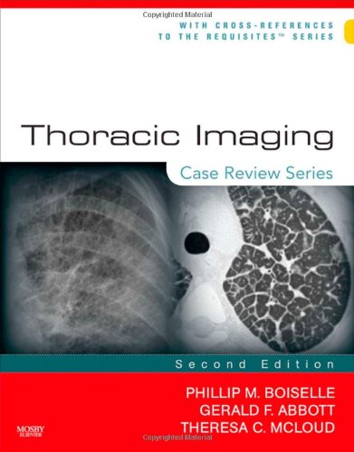 Download Thoracic Imaging: Case Review Series, 2e