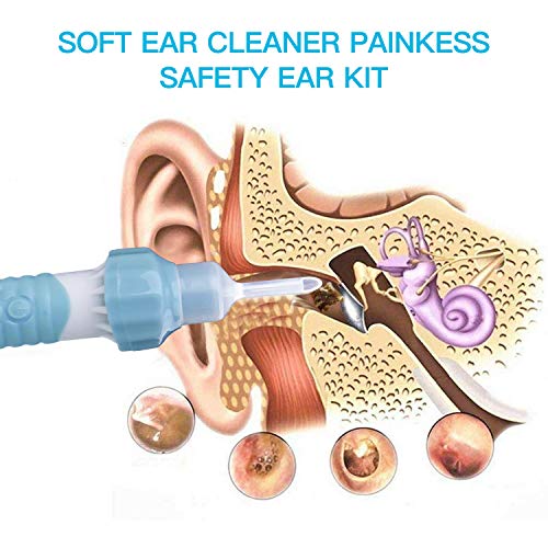 Ear Wax Removal Kit, Ear Cleaner, Electric Earwax Removal Tools, Ear Vacuum Cleaner Easy Earwax Remover Soft Prevent Ear-Pick Clean Tools Set with LED Light for Adults Kids - Blue