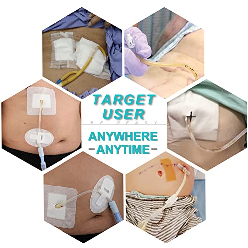 Peritoneal Dialysis PD Catheter Drain Split Bordered Gauze Island