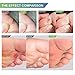 Wart Remover, Corn Remover Pads, Foot Corn Removal Plaster with Hole, Professional Removes Common and Plantar Warts, Callus, Stops Wart Regrowth 24Pcs