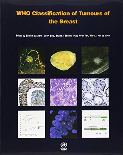 Breast Tumours: WHO Classification of Tumours (Medicine