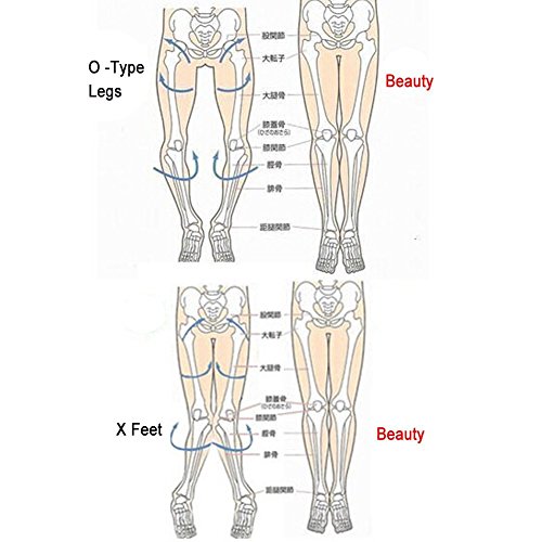 Healsmile® Authentic Bandages to Correct O type Legs Xtype Legs 3 Kits Available New Fashion O