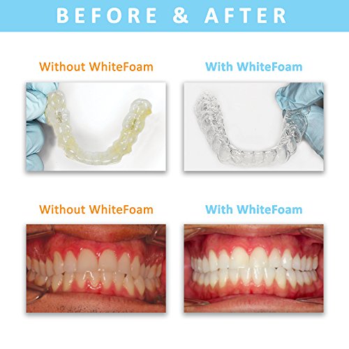 EverSmile WhiteFoam Invisalign Cleaner, Clear Retainer Cleaner & Tooth