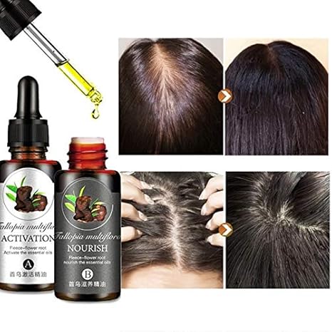 Buy Shoppy Shop Professional Anti Hair Loss Hair Growth Essential