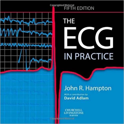 The Ecg In Practice Hampton Dm Ma Dphil Frcp Ffpm Fesc John 9780443068256 Amazon Com Books